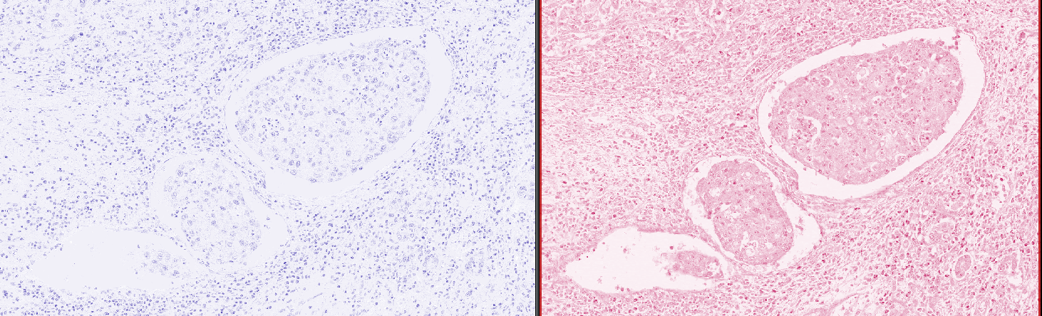 bad stain separation