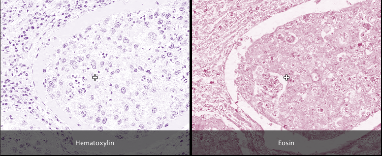 better stain separation