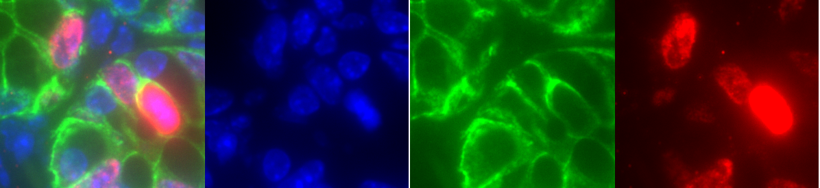 Composite image and the individual channels