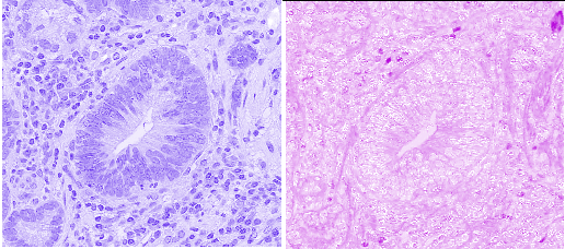 hematoxilin and eosin