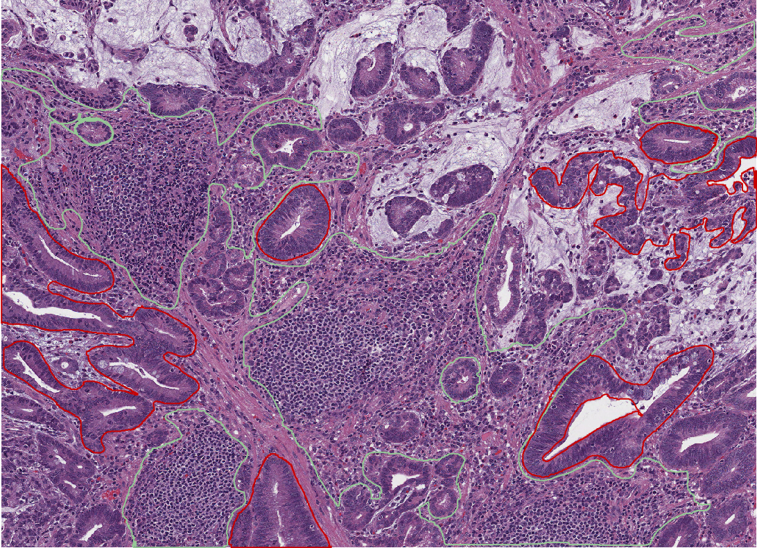 annotations classified