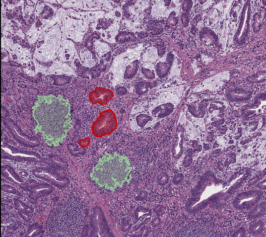 classifying annotations