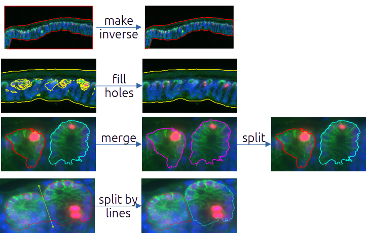 Editinig Annotations