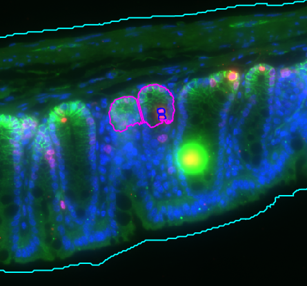 hierachical annotations