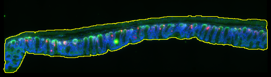 annotation of the section