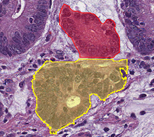 classifying annotations