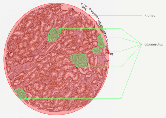 Final glomerulus manual