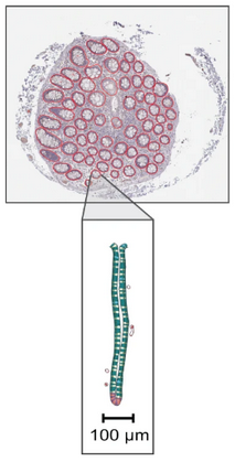 large intestine crypts